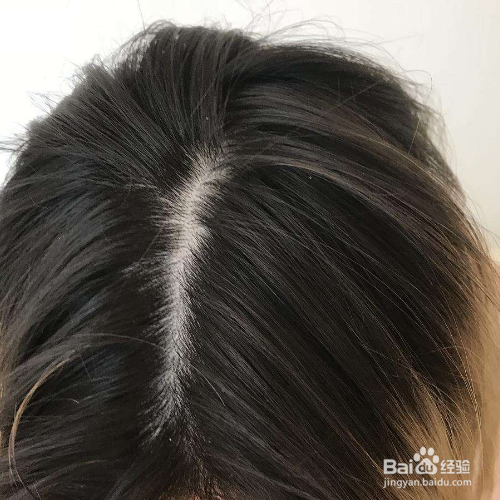 发梢老是往外翘是为什么