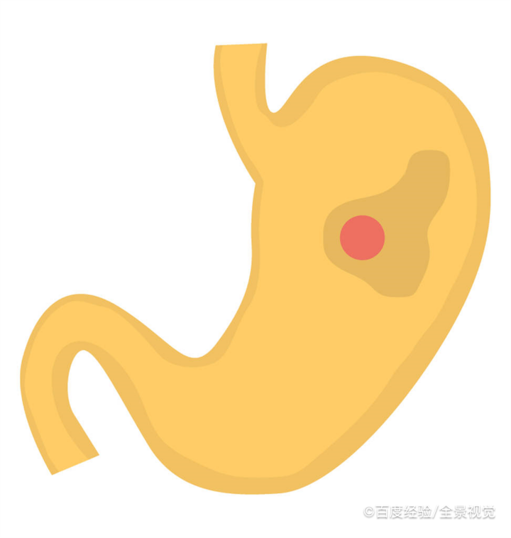 胃最怕哪些事