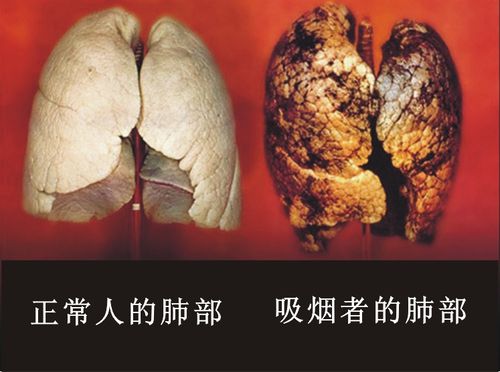 怎样有效防止二手烟