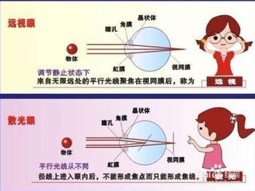如何正确防治青少年近视