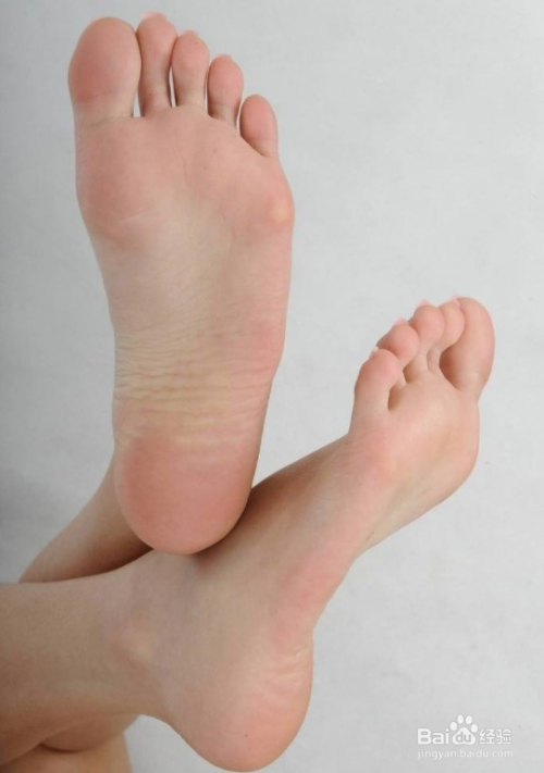 冬季脚痒怎么办?