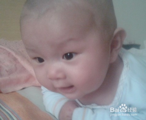 哪些宝宝更容易得湿疹？