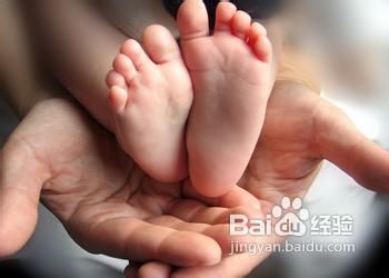 婴儿扁平足相关问题解答