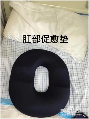 痔疮是否需要手术治疗