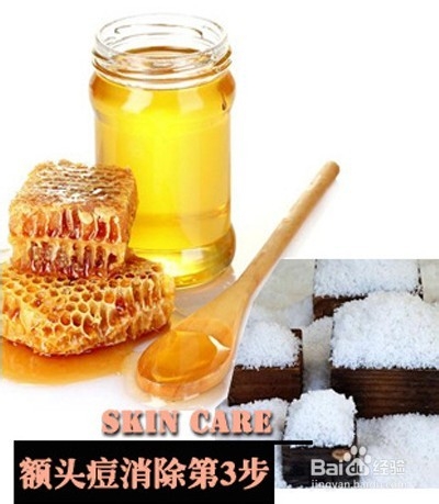 额头长痘痘28天快速消除顽强痘痘 祛痘