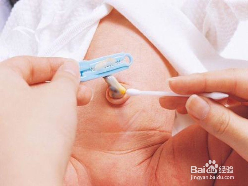如何护理好宝宝的脐带