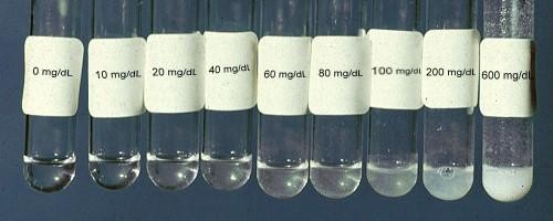 蛋白尿的治疗方法