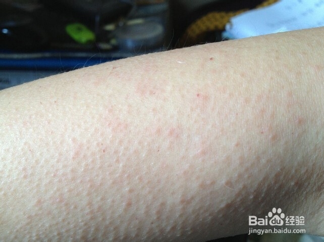 吃海鲜注意事项