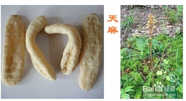 为什么会得偏头痛