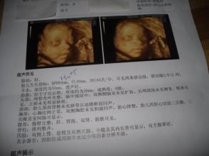 从怀孕到宝宝出生需要做的重要检查