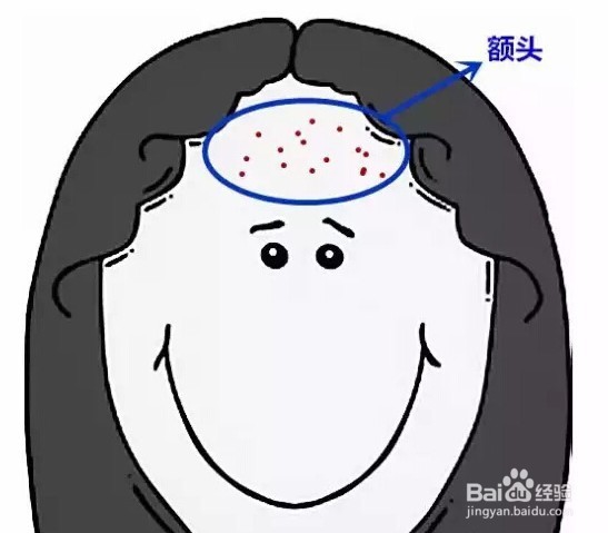 祛痘的图解,祛痘要坚持