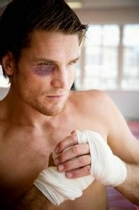 眼睛青肿如何治疗