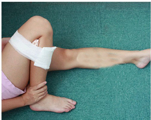 脚外伤出血急救