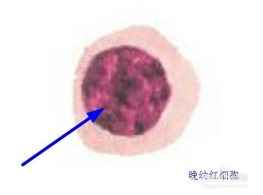 怎样辨认骨髓片子这是哪种细胞啊