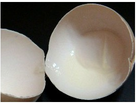 怎么去除黑头,方法终于全了