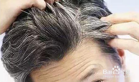 白发是怎样引起的,出现白发的原因有哪些 ?
