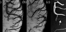 MRI的检查方法有哪些