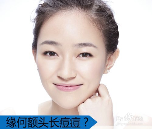 额头长痘怎调理 告别痘肌女