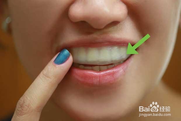 如何变白牙齿