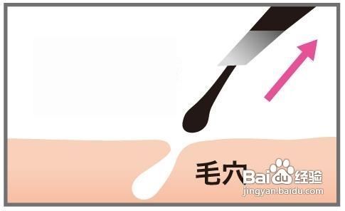 毛多怎么办?脱毛方法有哪些