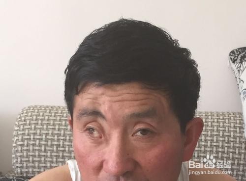 眼球震颤的危害