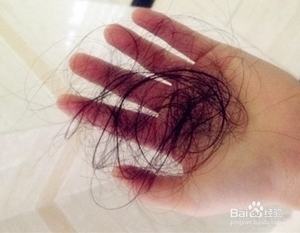 头发大把大把的掉这么办