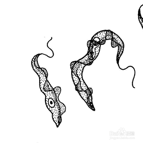 鞋板虫怎么才能消灭