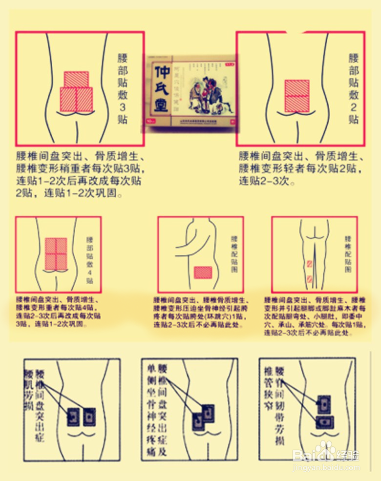 膏药使用疑问,我来解答