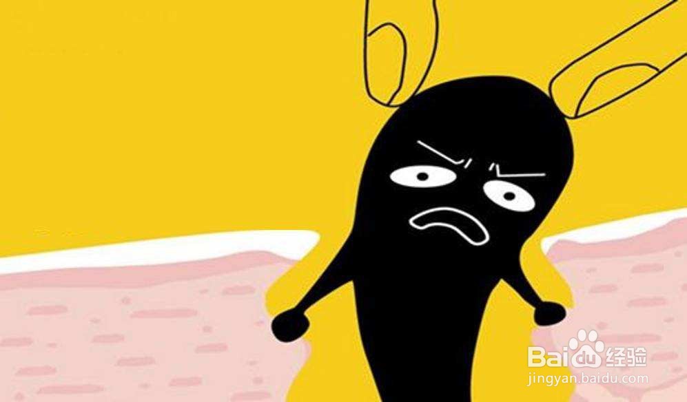 如何解决脸上的黑头和白头