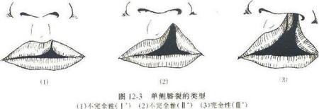 女为知己者——整形还是美容