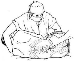 腰椎增生治疗方法