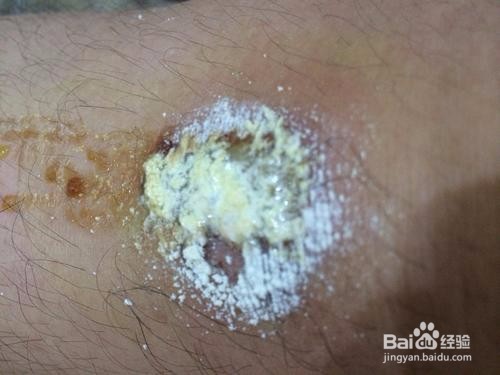 如何正确使用双氧水