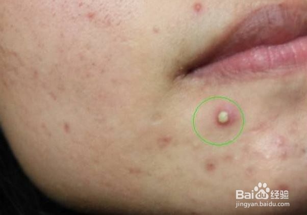 肝不好，脸上多半有4种现象