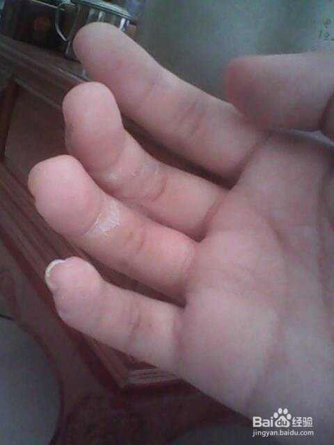 手上粘有强力胶、玻璃胶,怎么办?