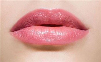 冬季嘴巴开裂怎么解决