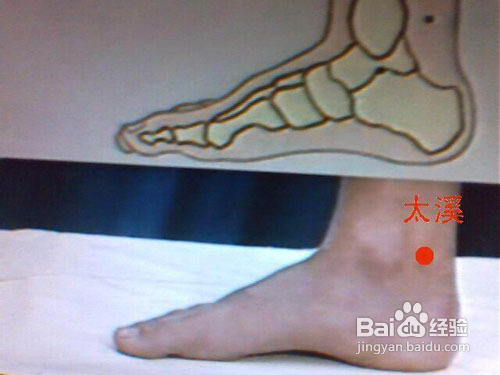 怎样去除黑眼圈？？？