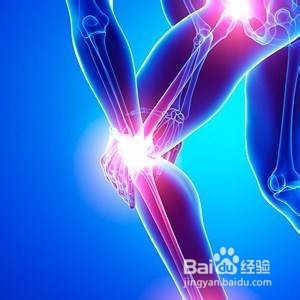 骨膜炎的最佳治疗方法