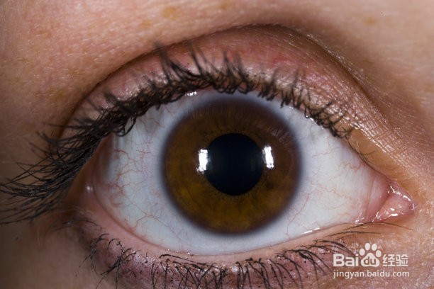 如何改善眼睛疲劳所带来的飞蚊症?