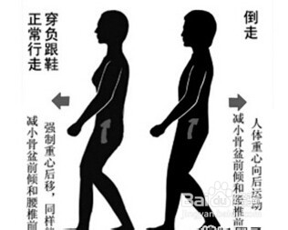 腰椎间盘突出患者该怎样锻炼