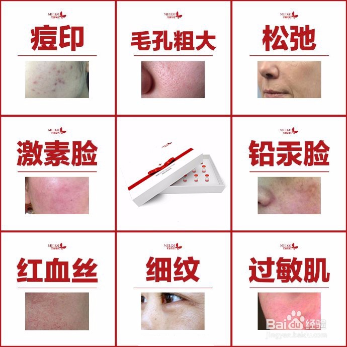 敏感肌肤换季时如何避免面部红血丝