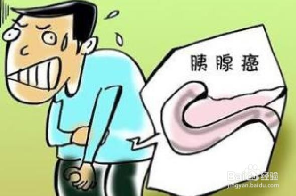 预防胰腺癌最简单的方法