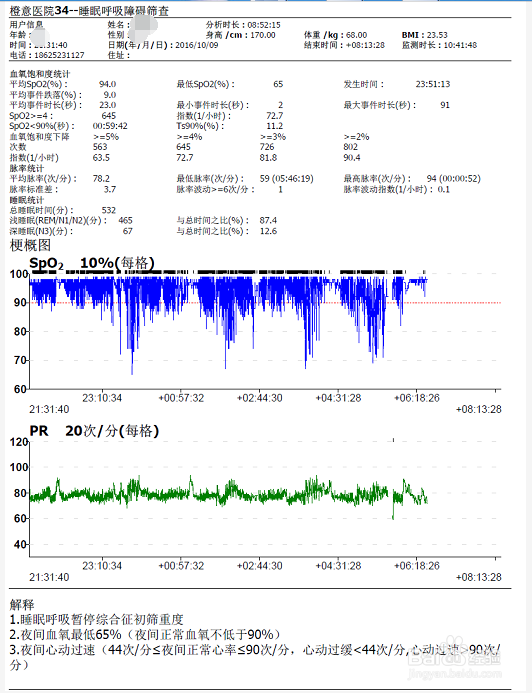 睡眠呼吸暂停综合征怎么快速检查？