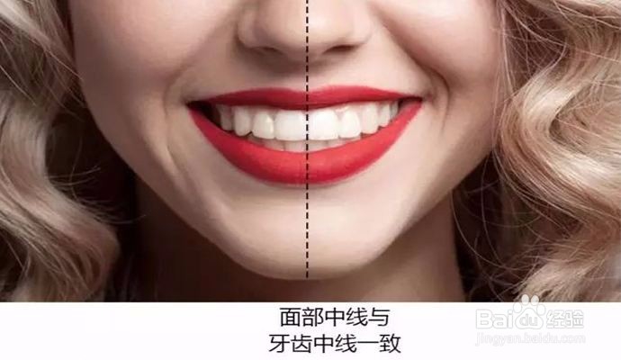 南宁牙齿矫正橡皮圈的作用有哪些？