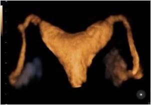 可以加快怀孕的一些方法