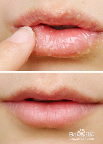 护唇技巧 打造性感嘟嘟唇