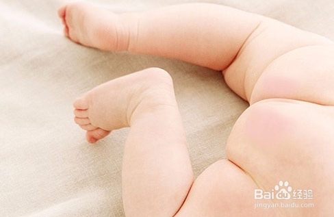 如何防治宝宝尿布疹/红屁屁