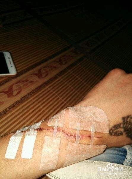 怎么洗纹身不留疤