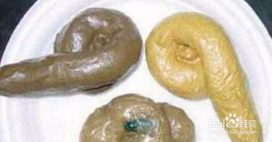 如何区分人的粪便和猫的粪便