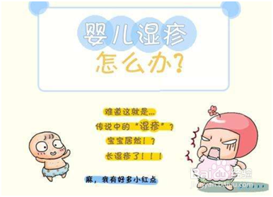 宝宝湿疹能否使用激素别将激素妖魔化!
