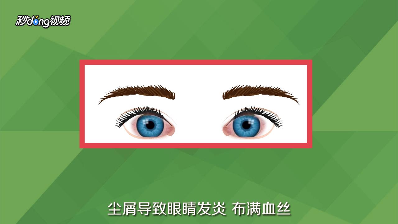 眼睛有红血丝怎么消除